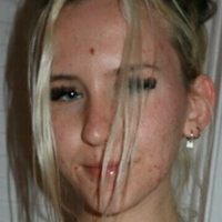 babykannabis Nackt