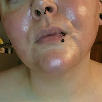 blemishedbeauty Nackt