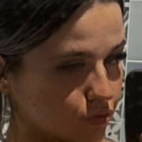 Chiomaoputa Nackt