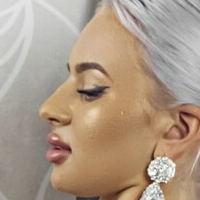 Florina Nackt