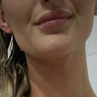 Marie Müller Nackt
