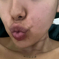 notyourbabyt Nackt