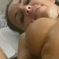 nykolerotic Nackt