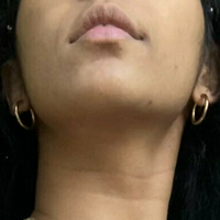 petitebabexo Nackt