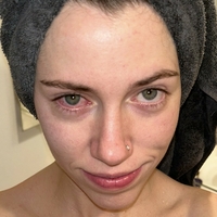 stellzgray Nackt