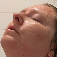 titlaser Nackt