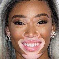 Winnie Harlow Nackt