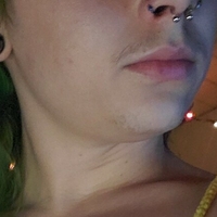 xxxanthisma Nackt