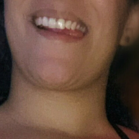 zoracensored Nackt